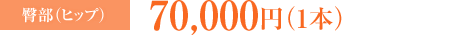 臀部（ヒップ）：70,000円（1本）